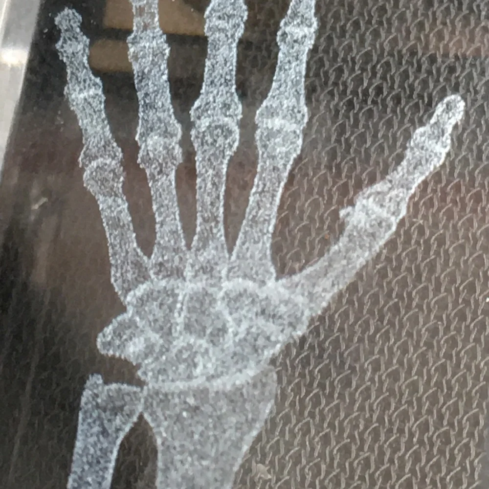 3D Crystal Hand Joint Structure Keychain with Protective Case